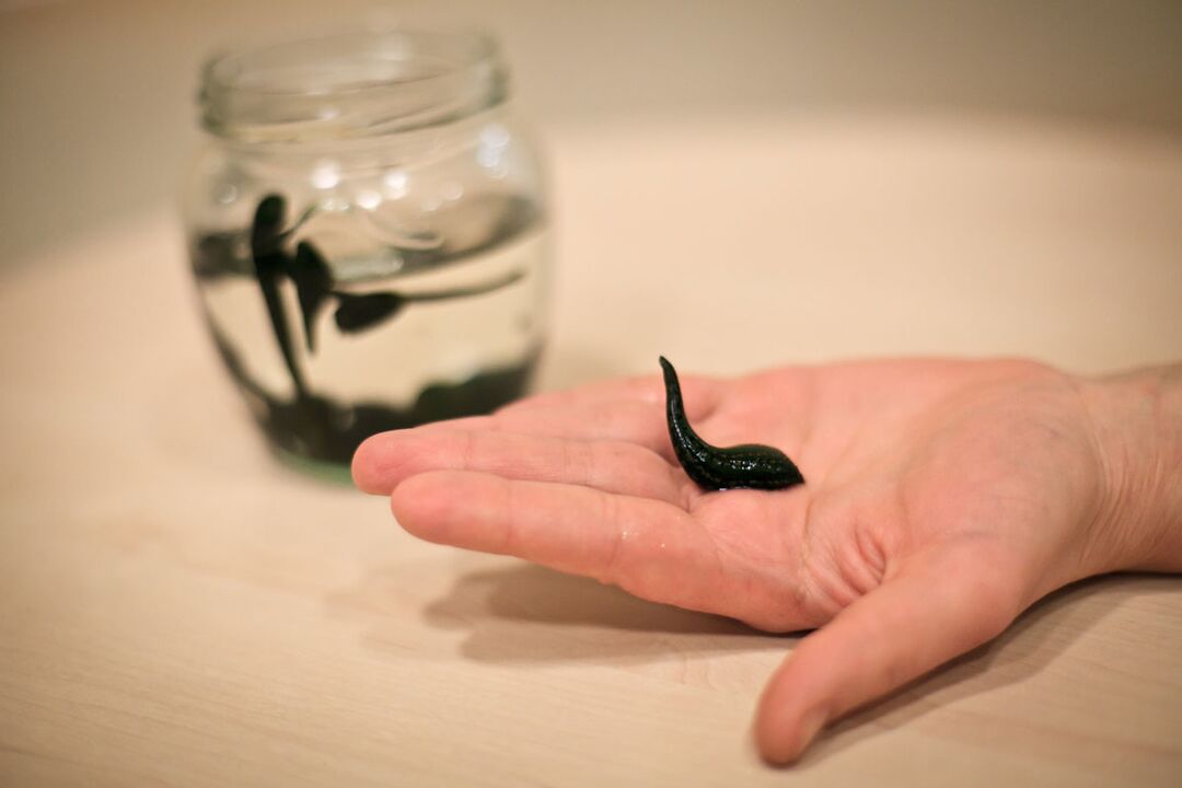 Leeches will serve as raw materials for the production of creams that stimulate penis growth